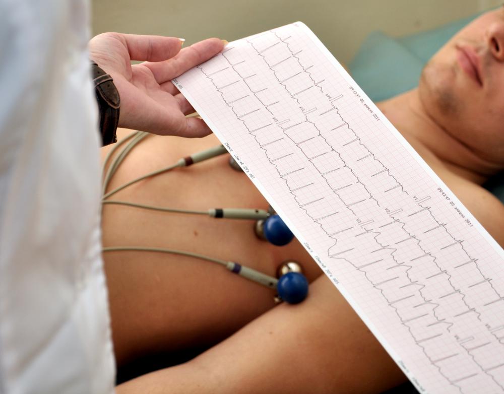 Electrocardiogram (ECG or EKG) pakistan sehatyabi.pk